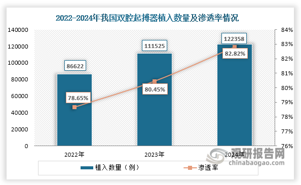 资料来源：公开资料、观研天下整理